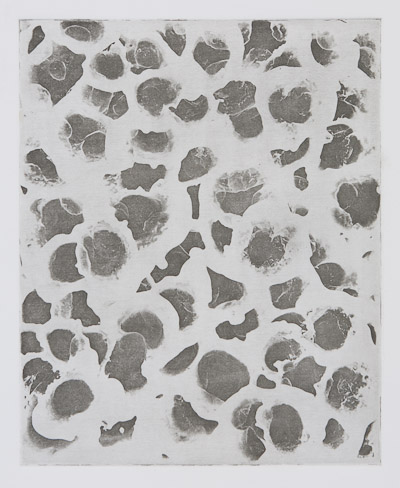 Etching by Dan Treado titled 'Smells Like Measles, Too' 